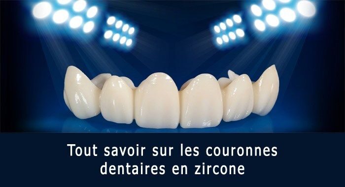 Couronnes dentaires