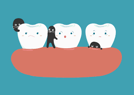 Prévention des caries