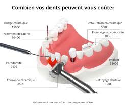 Coût soins dentaires