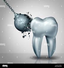 Dents solides