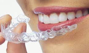 Invisalign prix Casablanca