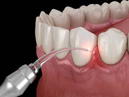 Soins rapides dent