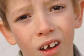 Dent cassée enfant