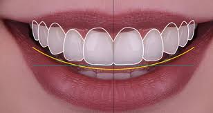 Design sourire