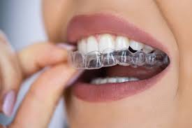 Traitement Invisalign