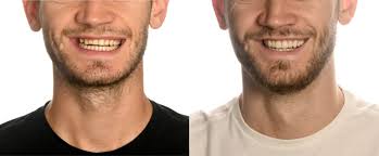 Transformation du sou